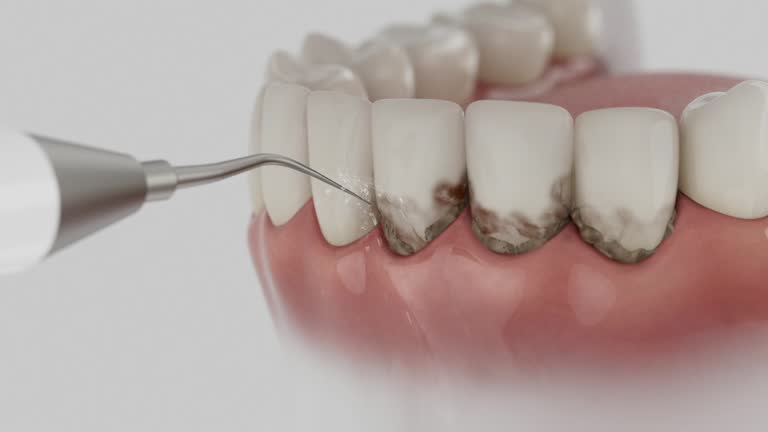 Trusted Root Canal Treatment service in Lake Lakengren, OH - Dentist Open Now